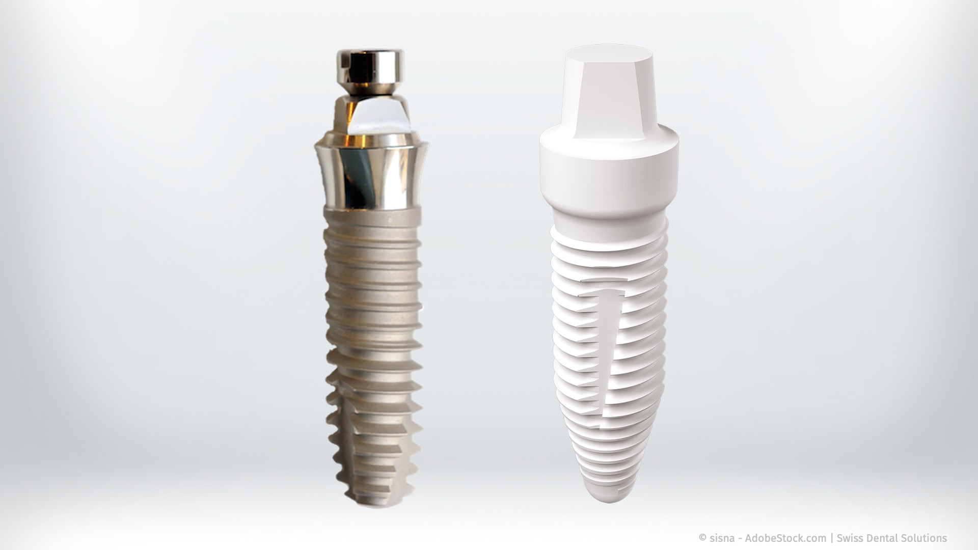 Keramikimplantate kosten unwesentlich mehr als Titanimplantate.